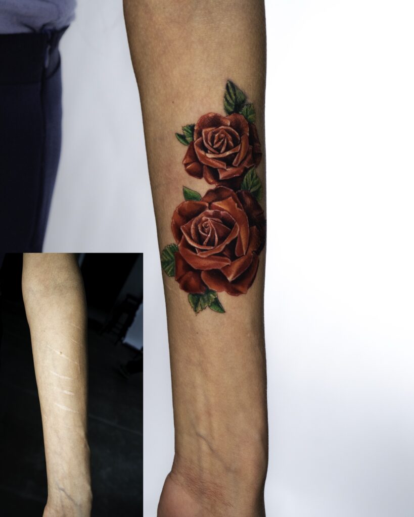 Coverup Floral Rose Tattoo